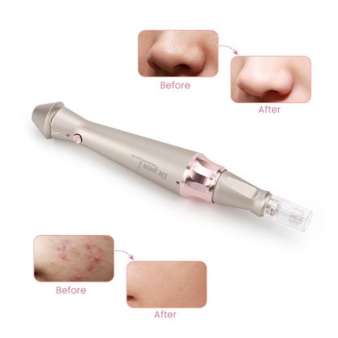 Dr.Pen E-30W Wireless - Pen PMU e Microneedling