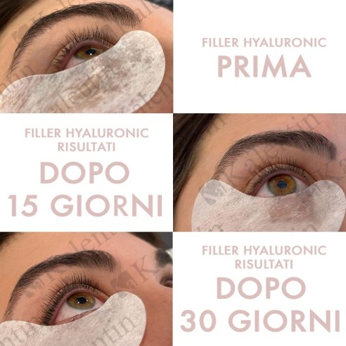 Filler Hyaluronic - Siero Vegano per Ciglia e Sopracciglia KALENTIN - 10ml