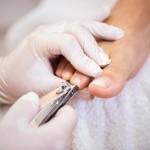 Pedicure