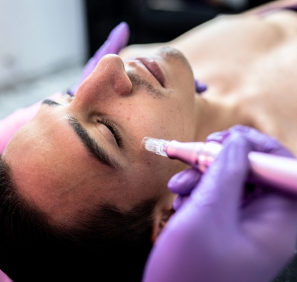 Needling