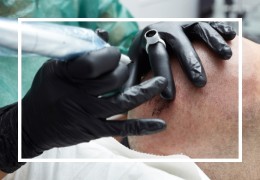 Tricopigmentazione: l'alternativa al trapianto da offrire nel tuo centro estetico